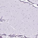 RHBDL3 Antibody in Immunohistochemistry (Paraffin) (IHC (P))