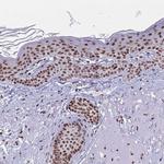 YTHDF2 Antibody in Immunohistochemistry (IHC)