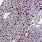 YTHDF2 Antibody in Immunohistochemistry (IHC)