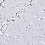 YTHDF2 Antibody in Immunohistochemistry (IHC)