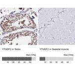 YTHDF2 Antibody