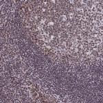 YTHDF2 Antibody in Immunohistochemistry (IHC)