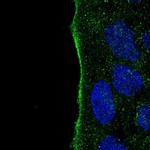 IYD Polyclonal Antibody
