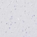 IYD Antibody in Immunohistochemistry (IHC)