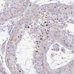 C19orf54 Antibody in Immunohistochemistry (Paraffin) (IHC (P))