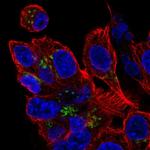 ZDHHC7 Polyclonal Antibody