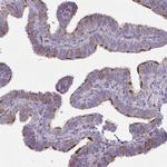 ZDHHC7 Antibody in Immunohistochemistry (Paraffin) (IHC (P))