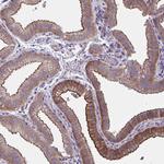 ZDHHC7 Antibody in Immunohistochemistry (Paraffin) (IHC (P))