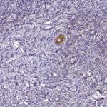 ZDHHC7 Antibody in Immunohistochemistry (Paraffin) (IHC (P))