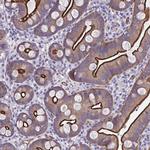 ZDHHC7 Antibody in Immunohistochemistry (Paraffin) (IHC (P))