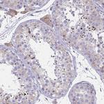 ZDHHC7 Antibody in Immunohistochemistry (Paraffin) (IHC (P))