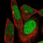 DTX3 Polyclonal Antibody