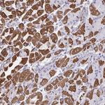 DTX3 Antibody in Immunohistochemistry (Paraffin) (IHC (P))