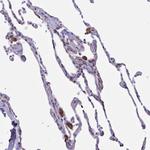 DCBLD1 Antibody in Immunohistochemistry (Paraffin) (IHC (P))
