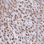 DCBLD1 Antibody in Immunohistochemistry (Paraffin) (IHC (P))