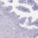 DCBLD1 Antibody in Immunohistochemistry (Paraffin) (IHC (P))