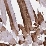 DCBLD1 Antibody in Immunohistochemistry (Paraffin) (IHC (P))