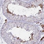 ZNF784 Antibody in Immunohistochemistry (Paraffin) (IHC (P))
