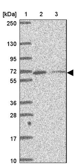 MYLK2 Antibody in Western Blot (WB)