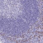 ANKDD1B Antibody in Immunohistochemistry (Paraffin) (IHC (P))