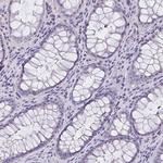 OR4A47 Antibody in Immunohistochemistry (Paraffin) (IHC (P))