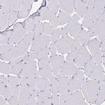 OR4A47 Antibody in Immunohistochemistry (Paraffin) (IHC (P))