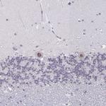 NUP133 Antibody in Immunohistochemistry (Paraffin) (IHC (P))