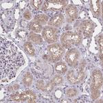 NUP133 Antibody in Immunohistochemistry (Paraffin) (IHC (P))