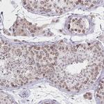 NUP133 Antibody in Immunohistochemistry (Paraffin) (IHC (P))
