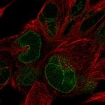 NUP133 Polyclonal Antibody