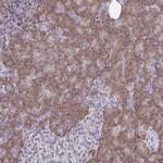 TM41A Polyclonal Antibody