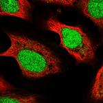 METTL17 Polyclonal Antibody