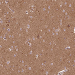 METTL17 Antibody in Immunohistochemistry (Paraffin) (IHC (P))