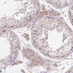 METTL17 Antibody in Immunohistochemistry (Paraffin) (IHC (P))