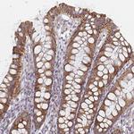 CTHRC1 Antibody in Immunohistochemistry (Paraffin) (IHC (P))