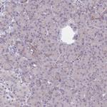 CTHRC1 Antibody in Immunohistochemistry (Paraffin) (IHC (P))