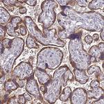 CTHRC1 Antibody in Immunohistochemistry (Paraffin) (IHC (P))