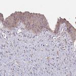 CTHRC1 Polyclonal Antibody