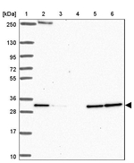 HDHD2 Antibody in Western Blot (WB)