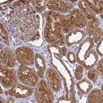 HDHD2 Antibody in Immunohistochemistry (IHC)