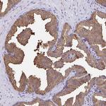 WDR72 Antibody in Immunohistochemistry (Paraffin) (IHC (P))