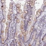 WDR72 Antibody in Immunohistochemistry (Paraffin) (IHC (P))