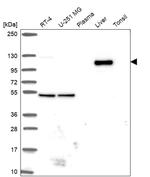 WDR72 Antibody in Western Blot (WB)