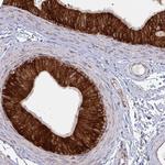 LYSMD4 Polyclonal Antibody