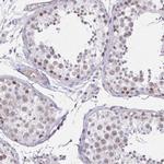 ANKRD62 Antibody in Immunohistochemistry (IHC)