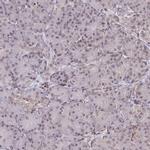 NIP7 Antibody in Immunohistochemistry (IHC)