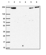 Periplakin Antibody in Western Blot (WB)
