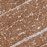 METTL22 Polyclonal Antibody