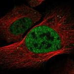 DISP2 Antibody in Immunocytochemistry (ICC/IF)