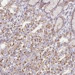 DISP2 Antibody in Immunohistochemistry (Paraffin) (IHC (P))